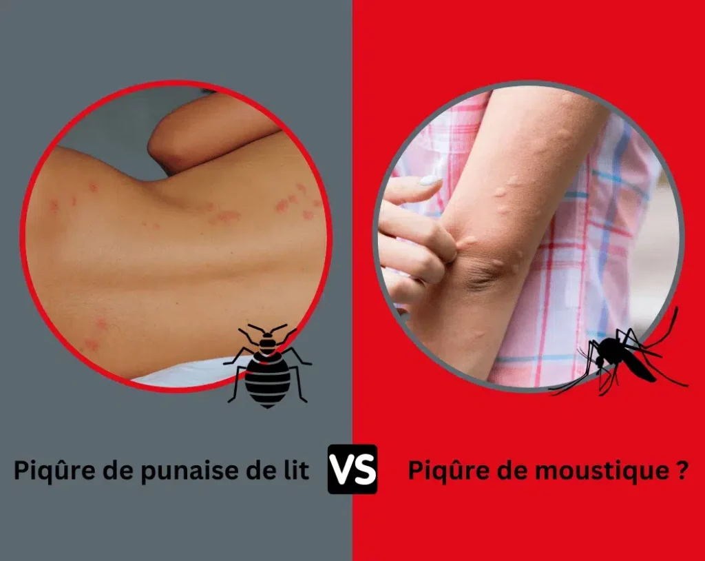Boutons rouges alignés sur la peau, différence piqûres punaises de lit et moustiques